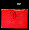 Amnesiac (2001)